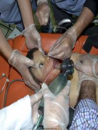 congress-hears-testimony-from-a-doctor-who-is-treating-victims-of-alleged-chlorine-attacks-in-syria-1434576638.jpg
